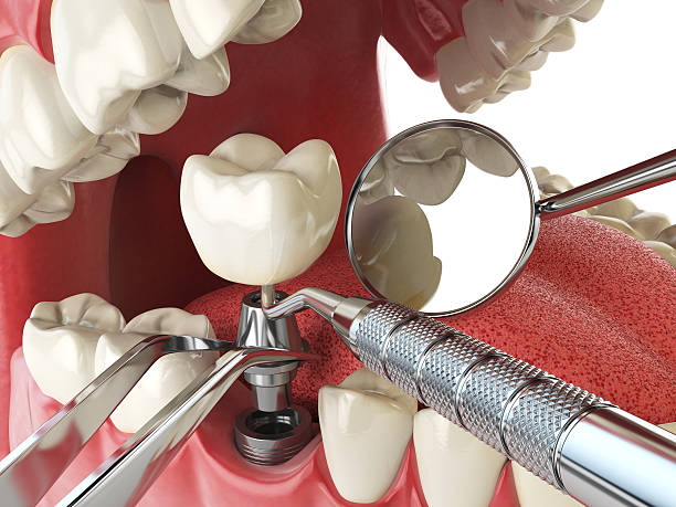 Best Pediatric Emergency Dentist in Brook Park, OH